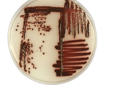Serratia marcescens: Properties, Pathogenesis, Diagnosis.